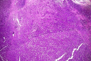 Giải phẫu bệnh - Cuộc cách mạng trong chẩn đoán bệnh chuyên sâu