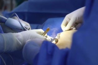 Dẹp nạn thẩm mỹ “chui”, kém chất lượng