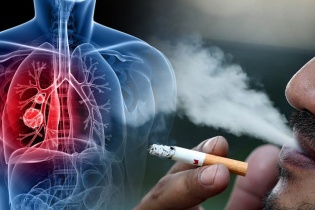 Tin mới y tế ngày 9/11: Gánh nặng bệnh ung thư tại Việt Nam; ca bệnh sốt xuất huyết ở TP.HCM vẫn tăng