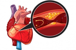 Nhồi máu cơ tim cấp vì thói quen hút thuốc lá và cảnh báo từ chuyên gia