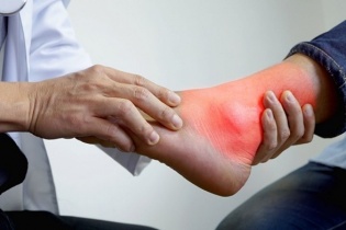 Nam sinh 17 tuổi mắc bệnh gút mạn mà không hề hay biết