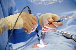 Tin mới y tế ngày 26/1: Giảm đau đớn cho người bệnh trong phẫu thuật