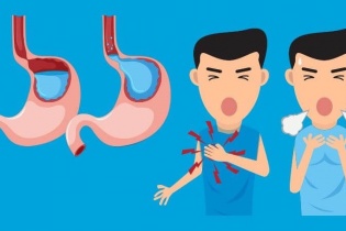 Ung thư thực quản và những triệu chứng dễ bị bỏ qua