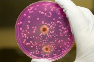 Tin mới y tế ngày 4/4: Theo dõi chặt chẽ các ca bệnh chưa rõ nguyên nhân tại Liên bang Nga