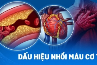 Tin mới y tế ngày 16/4: Dấu hiệu cảnh báo sớm các cơn nhồi máu cơ tim nguy hiểm