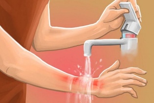 Tin mới y tế ngày 26/5: Bước tiến mới trong ứng dụng công nghệ y học vào phẫu thuật tạo hình và điều trị bỏng