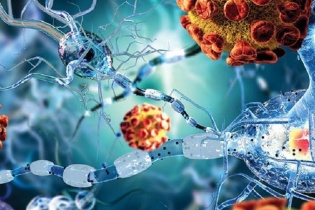 Bệnh do hệ miễn dịch gây ra: Dễ nhầm, khó chữa nếu phát hiện muộn