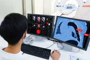 Tin mới y tế ngày 3/7: Bước đột phá trong chẩn đoán hình ảnh tại Việt Nam