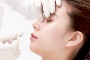 Cảnh báo biến chứng nghiêm trọng do tiêm filler không rõ nguồn gốc
