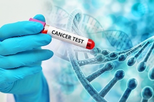 Bệnh nhân mắc cùng lúc hai loại ung thư có tiền sử hút thuốc lá, uống rượu