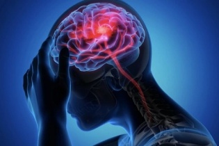 Chóng mặt kéo dài 2 tuần, người đàn ông 52 tuổi phát hiện nhồi máu não