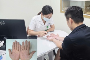 Cẩn trọng với những vi khuẩn nguy hiểm trong nước lũ