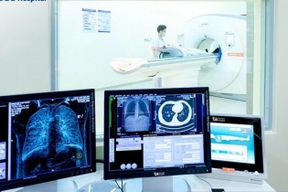 Hút thuốc hàng chục năm, nhiều người phát hiện ung thư phổi khi đã muộn