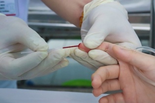 Tin mới y tế ngày 20/10: Gặp biến chứng sốt xuất huyết vì tự ý điều trị