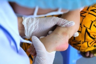 Sở Y tế TP.HCM cảnh báo tác nhân EV71 xuất hiện trở lại