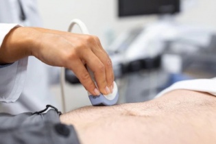 Phát hiện áp xe gan từ triệu chứng sốt cao, mệt mỏi không rõ nguyên nhân