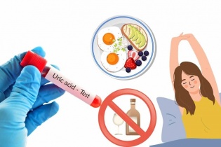 Cảnh báo xu hướng trẻ hóa bệnh gút