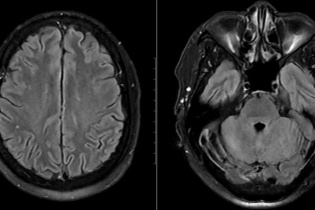 Cảnh báo hệ lụy từ món ăn “quen thuộc” ngày Tết