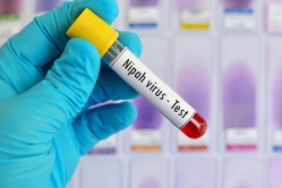 Bộ Y tế siết giám sát dịch bệnh dịp Tết Bính Ngọ 2026, chủ động ứng phó nguy cơ virus Nipah