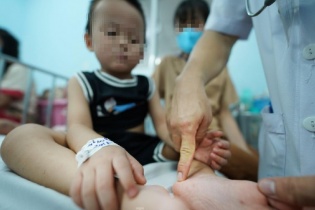 Tay chân miệng ghi nhận trẻ tử vong, Bộ Y tế yêu cầu siết điều trị trên toàn quốc