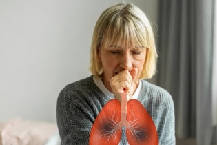Tin mới y tế ngày 15/5: Giảm nguy cơ lây bệnh lao trong cộng đồng
