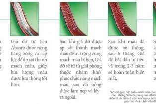 Abbott lọt top những công ty sáng tạo nhất thế giới