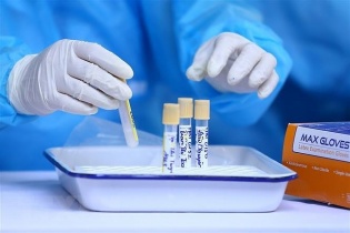 Thủ tướng khen CDC, Sở Y tế TP Đà Nẵng có thành tích phòng, chống dịch Covid-19