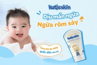 Giải đáp độ hot của kem bôi dịu da cho bé Kutieskin