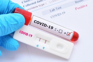 Quảng Ninh không chấp nhận kết quả test nhanh Covid-19 để vào tỉnh