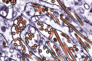 Lần đầu tiên ghi nhận ca mắc cúm gia cầm ở người không tiếp xúc với động vật