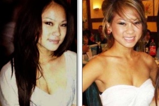 Thiếu nữ gốc Việt bị đánh đến chết não ngoài hộp đêm