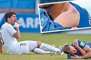 Truyền thông Italy gọi Suarez là "quỷ hút máu người" Dracula