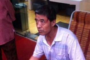 Hy hữu người đàn ông bị  dao rơi từ "trên trời" cắm ngập đầu 10cm