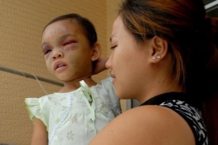 Cha mẹ "hờ" đánh dã man bé gái 4 tuổi có thể khởi tố về tội giết người