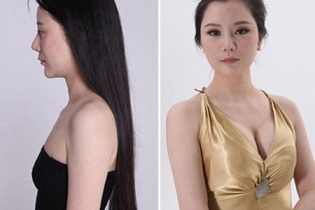 Những ca phẫu thuật thẩm mỹ "làm khó" nhân viên an ninh hàng không