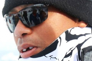 Tay golf Tiger Wood rụng răng cửa vì va chạm với phóng viên